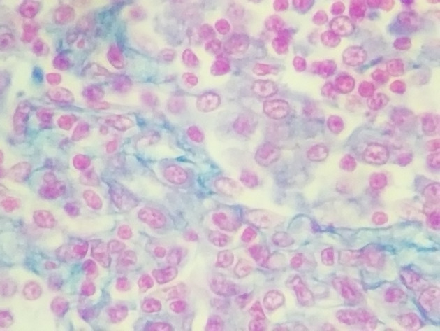 Reticular Connective Slides - Reticular Connective 05 400X